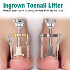 1pc Professional Ingrown Nail Corrector Tool - Softens and Easily Trims Ingrown Toenails - Pedicure Tools for Nail Correction and Recovery